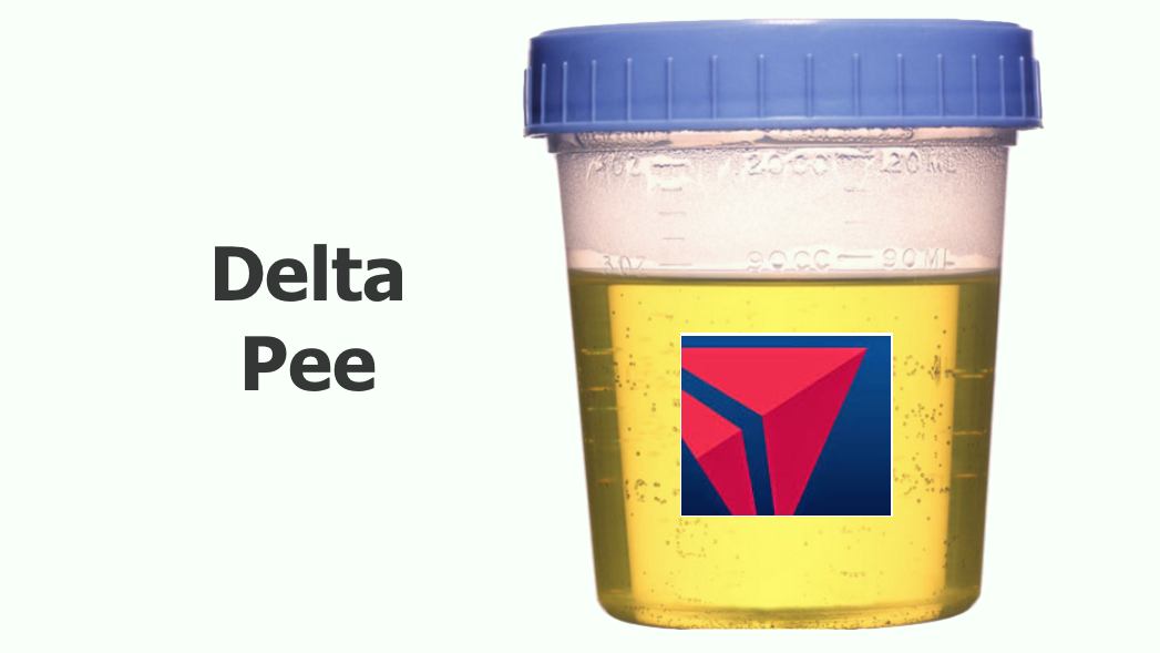 APG 213 – Delta Pee